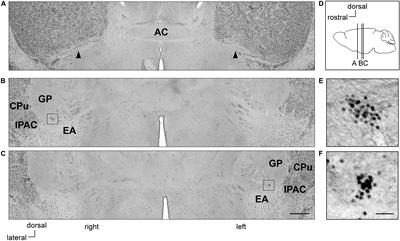 Stress-Related Neuronal Clusters in Sublenticular Extended Amygdala of Basal Forebrain Show Individual Differences of Positions